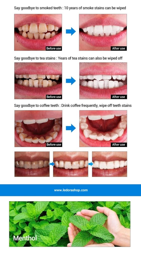 محلول سفید کننده دندان لانبنا