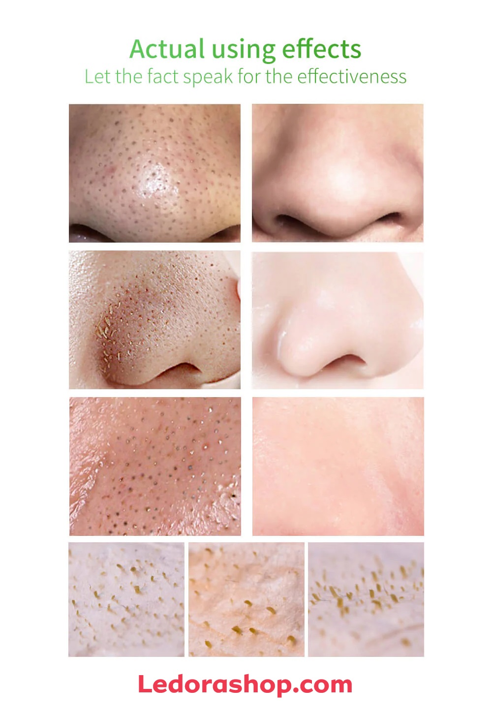 چسب بینی لانبنا لاکی سبز